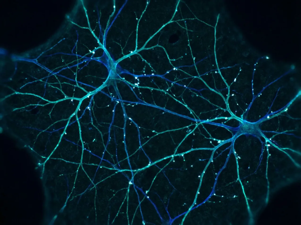 Neural pathways